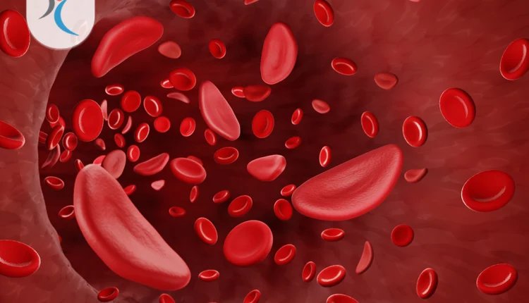 فقر الدم أعراض فقدر الدم أسباب فقر الدم طريقة معالجة فقر الدم الأطعمة التي تساعد على رفع نقص الدم الأغذية التي تؤدي الى امتصاص الحديد من الجسم الأنيميا الهيموغلوبين